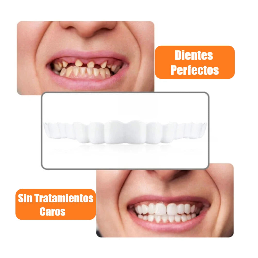 Carillas Dentales Removibles Ajustables – Sonrisa Perfecta en Minutos [Pagás 1 y Llevás 4]