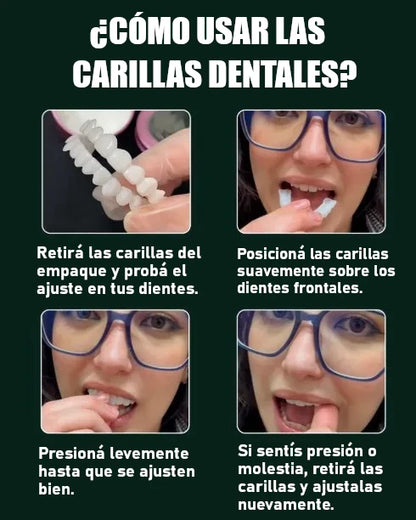 Carillas Dentales Removibles Ajustables – Sonrisa Perfecta en Minutos [Pagás 1 y Llevás 4]